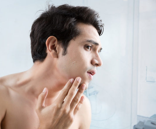 Common skincare mistakes men make